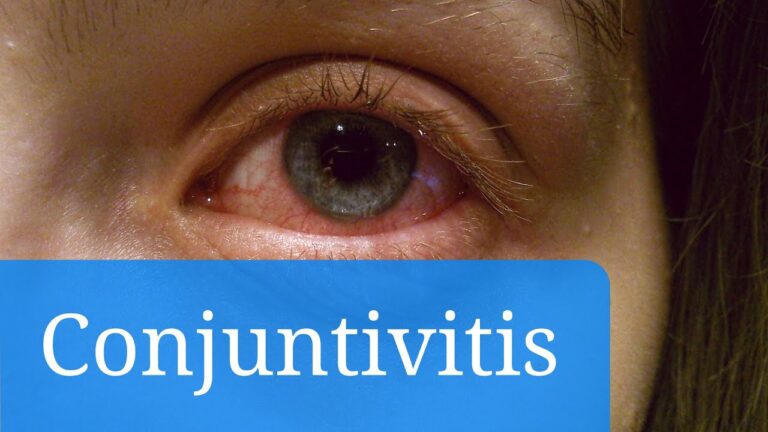 ¿Conjuntivitis o mocos en los ojos en niños? Descubre la clave para diferenciarlos