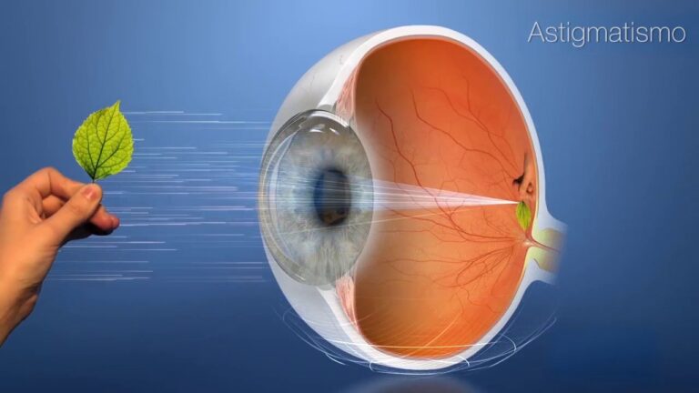 Cómo perciben las luces las personas con astigmatismo: descubre más en este artículo
