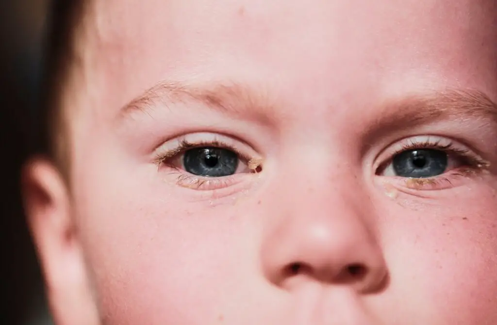 ¿Conjuntivitis o mocos en los ojos en niños? Diferencias