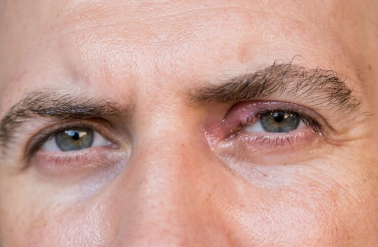 Enfermedades de los Ojos en Personas Adultas: Guía Completa
