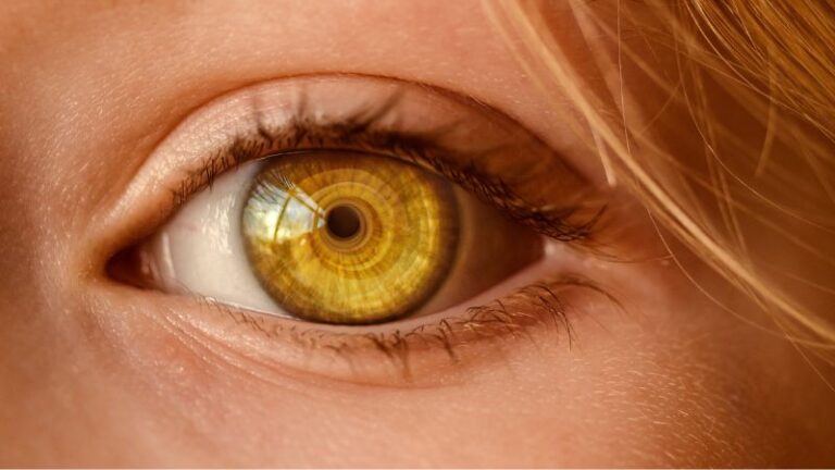 Manchas en los Ojos Amarillas: Causas, Síntomas y Tratamientos